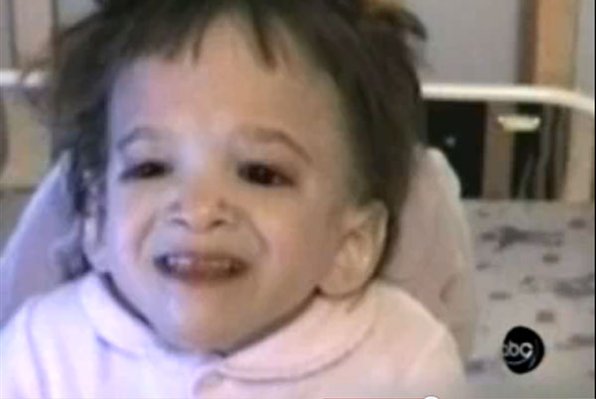 djevojčica, starenje, geni