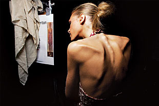 anoreksija, zlostavljanje, moda