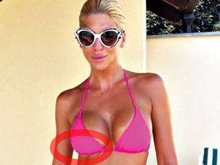 jelena karleuša, silikoni