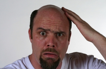 ćelavost, lijek, kosa, opadanje, ćelavost