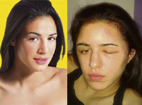 manekenka, šampon, Katarina Prlinčević