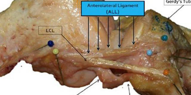 Belgijski kirurzi, novi dio ljudskog tijela, ligament, prednjeg križnog ligamenta, sportska povreda