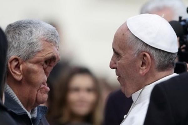 Papa Franjo, čovjek bez lica, poljubio i zagrlio
