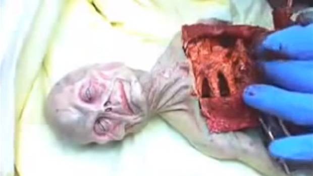 izvanzemaljci, obdukcija