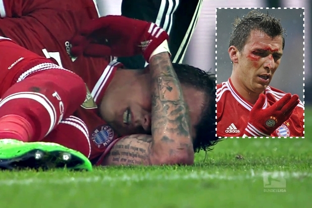 Mario Mandžukić, nokaut