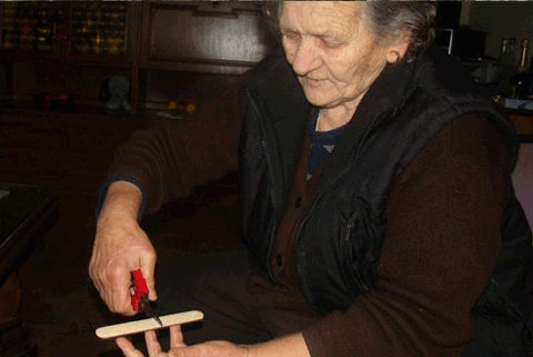 Stana Mihaljević, ruke, noge, namještanje