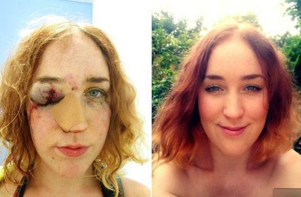 karneval, lice, udarac, Nepoznati muškarac