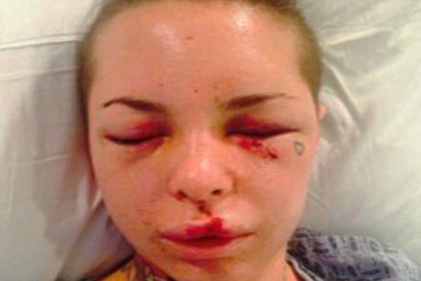 prebijena porno glumica