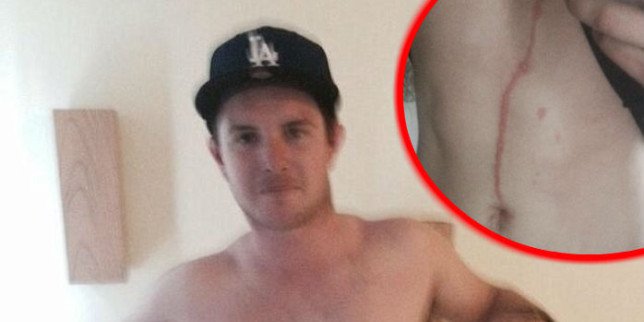 ožiljak, pauk, životinja