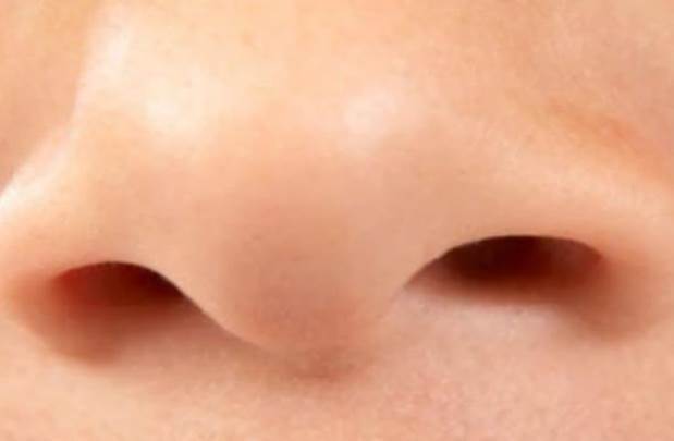 nos, miris, zdravlje