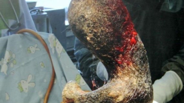 kosa, ovisnost, želudac