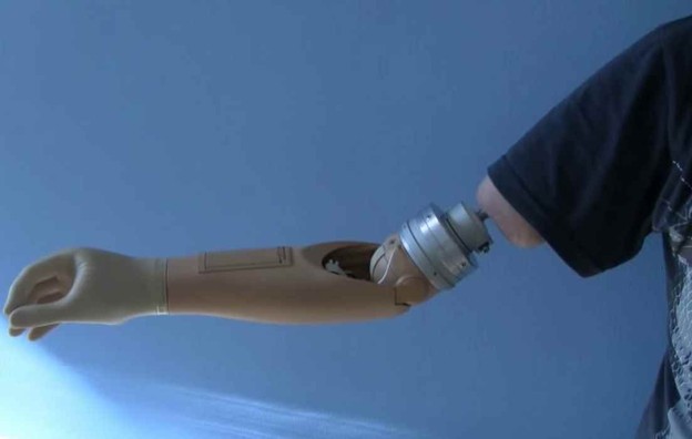 protetski udovi, umjetna ruka, znanstvenici