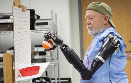  Sveučilište Johns Hopkins APL, bioničke ruke, Les Baugh,  Prostetička tehnologija