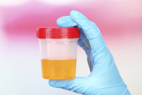 bakterija, Klebsiella pneumoniae , urin