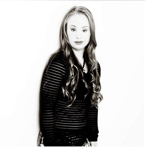 djevojčica, Down sindrom, model