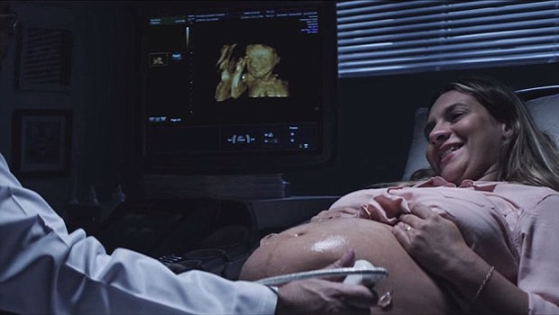 trudnica, slijepa, ultrazvuk, Hrvatska, pobačaj, smanjenje pobačaja