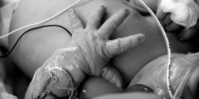 SKB Mostar, smrt bebe, Mostar