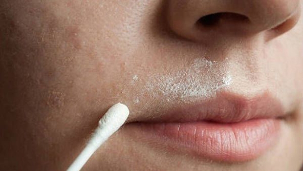 Uklanjanje dlačica, lice, prirodni sastojci , prirodna maska, dlačice na licu, lice, čišćenje, čišćenje lica, prirodna maska