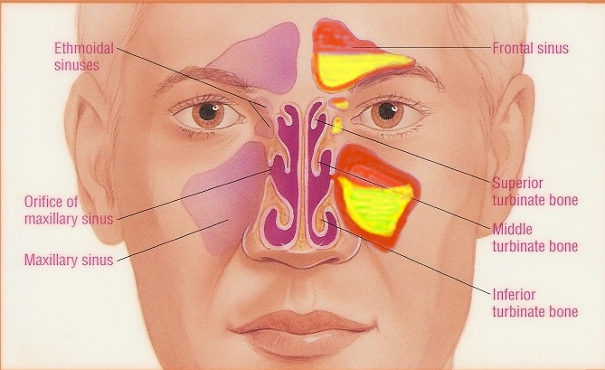 Akutni sinusitis, upala sluznice, inhalacija, eterična ulja, aromaterapija, Akutni sinusitis, sinusi, zubobolja