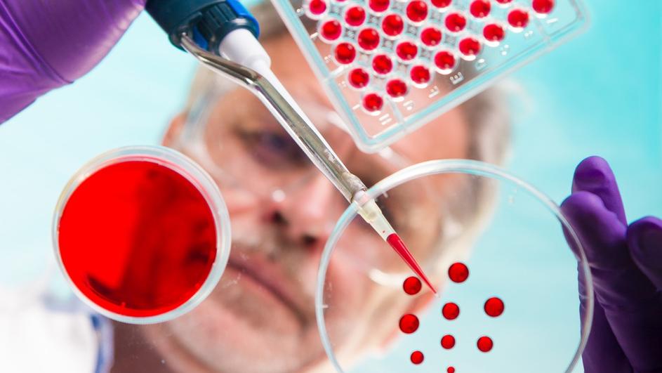 željezo, organizam, tablete, tijelo, željezo, organizam