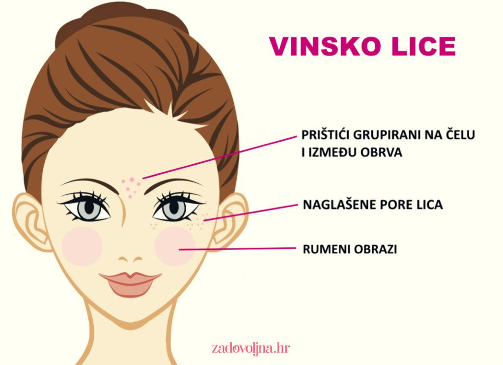 promjene, lice, hrana