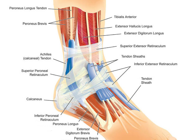 skočni zglob, povrede, ligamenti, iščašenja zglobova, Bolesti zglobova