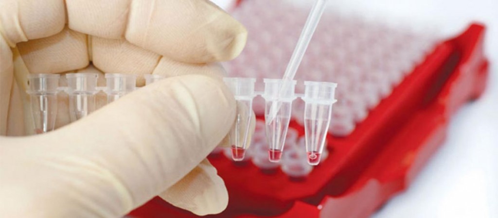 analiza krvi
