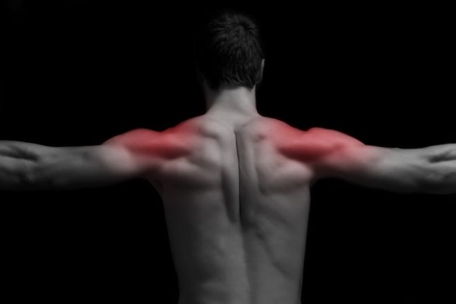 upala mišića, ublažiti bol, načini