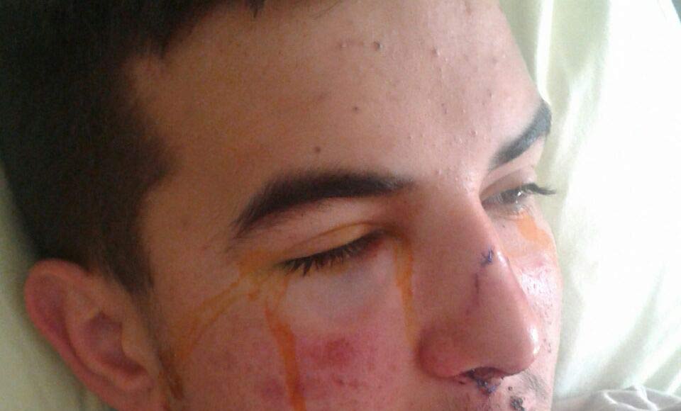 Široki Brijeg, pretučeni dječak, pretučeni mladić, Široki Brijeg, premlaćivanje, mile soldo, mile soldo, Široki Brijeg