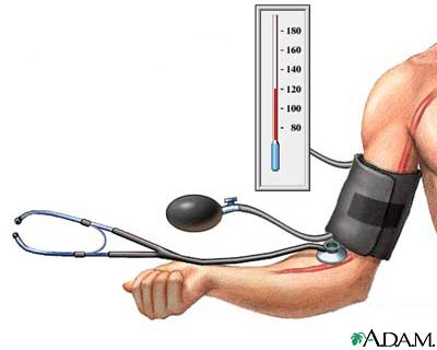 krvni tlak, ubojica, visok tlak , namirnice, snižavanje krvnog tlaka