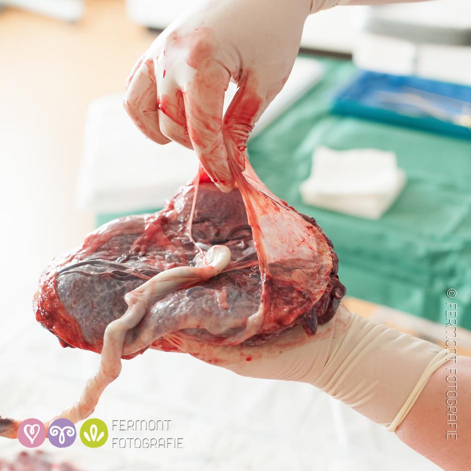 stručnjaci, dokazi, posteljica 