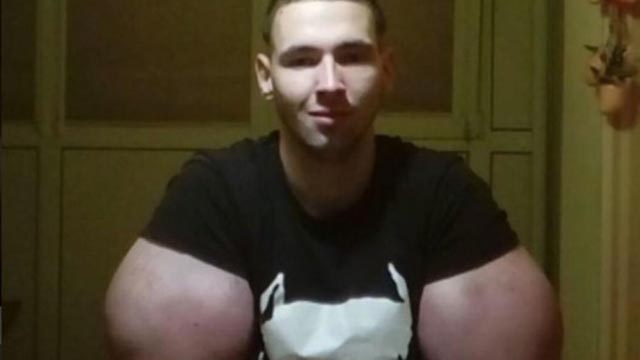 synthol