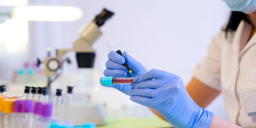 Alzheimerova bolest, zdravlje, znakovi, amazona, jegulja