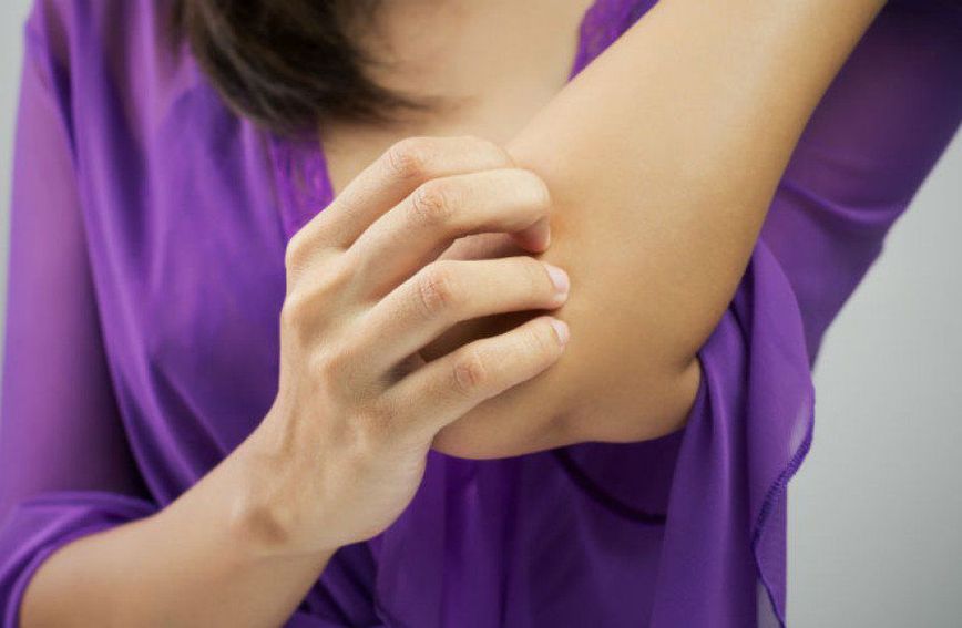 komarci, komarac, ubod insekta, ubod, ublažavanje uboda