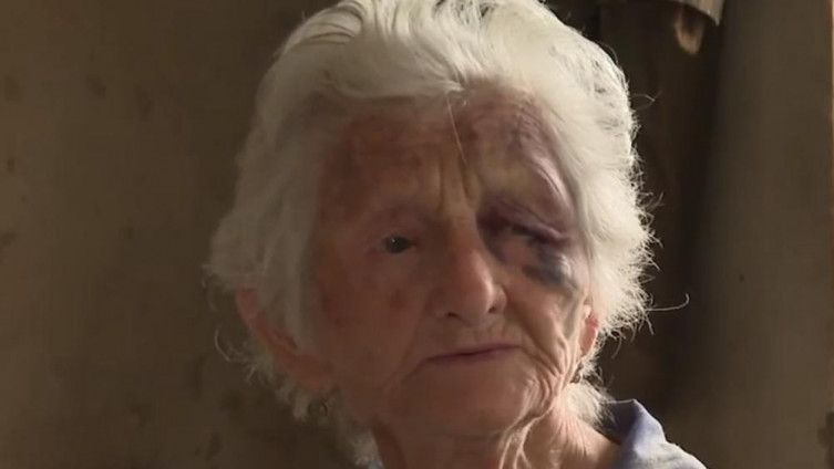 Subotica: Nesretna starica koju su pretukli zbog 25 eura u šoku: Prijetili da će je ubiti ako ne da još novca