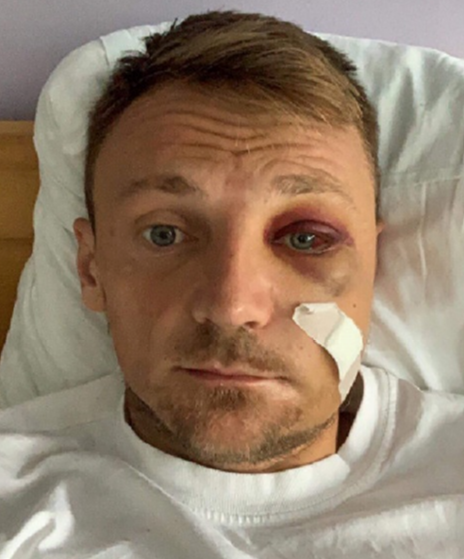 semir bukvić, operacija