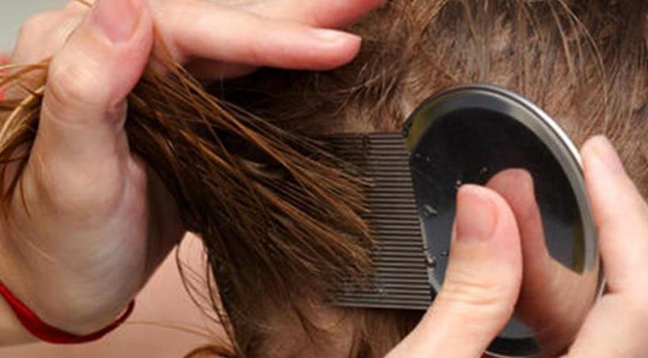 uši, Mostar, epidemija