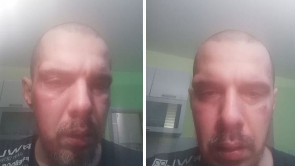 bojan tomović, pretučen