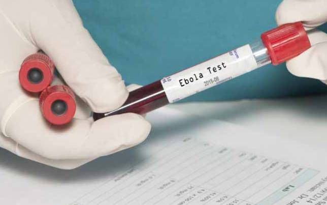 ebola, denge, računalni model, virus