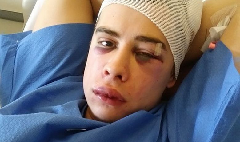 pretučen, koncert, Zagreb