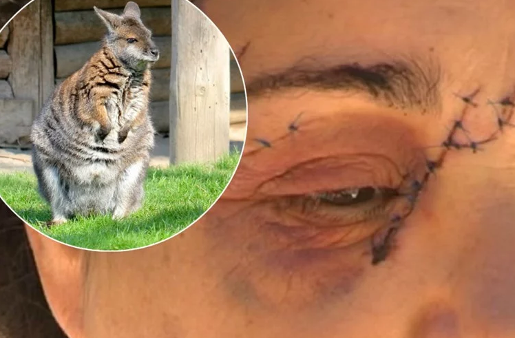 žena, Australija, klokani