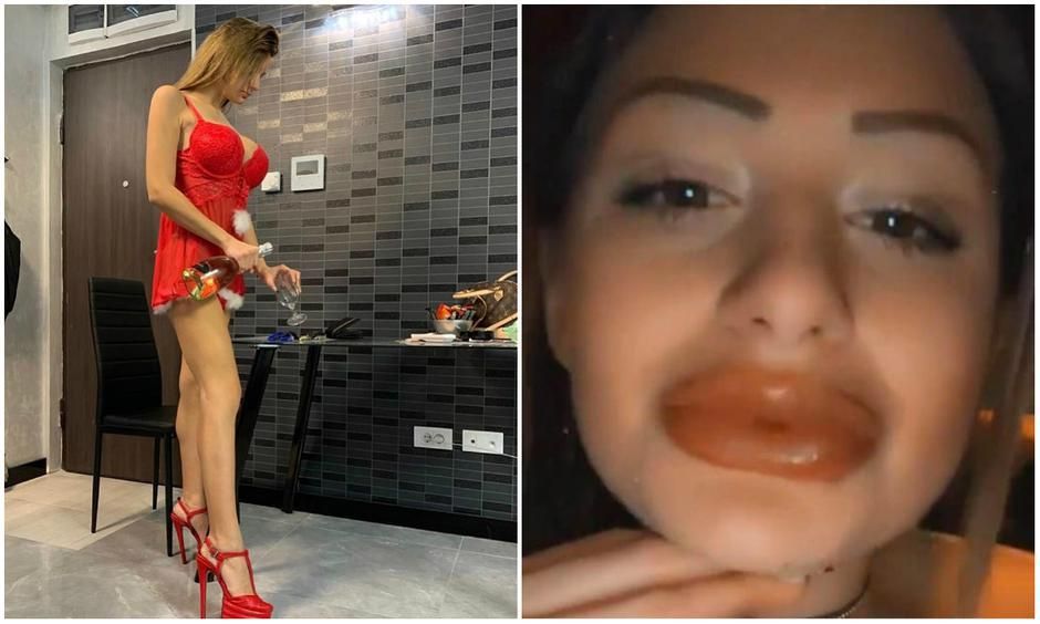 kristina mandarina, estetska kirurgija, promjena