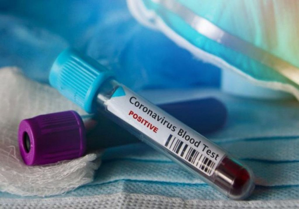 virus, muškarac, zaraza, Osijek, koronavirus, ministarstvo zdravstva, koronavirus, Hrvatska, koronavirus, upute, koronavirus, Republika Srpska