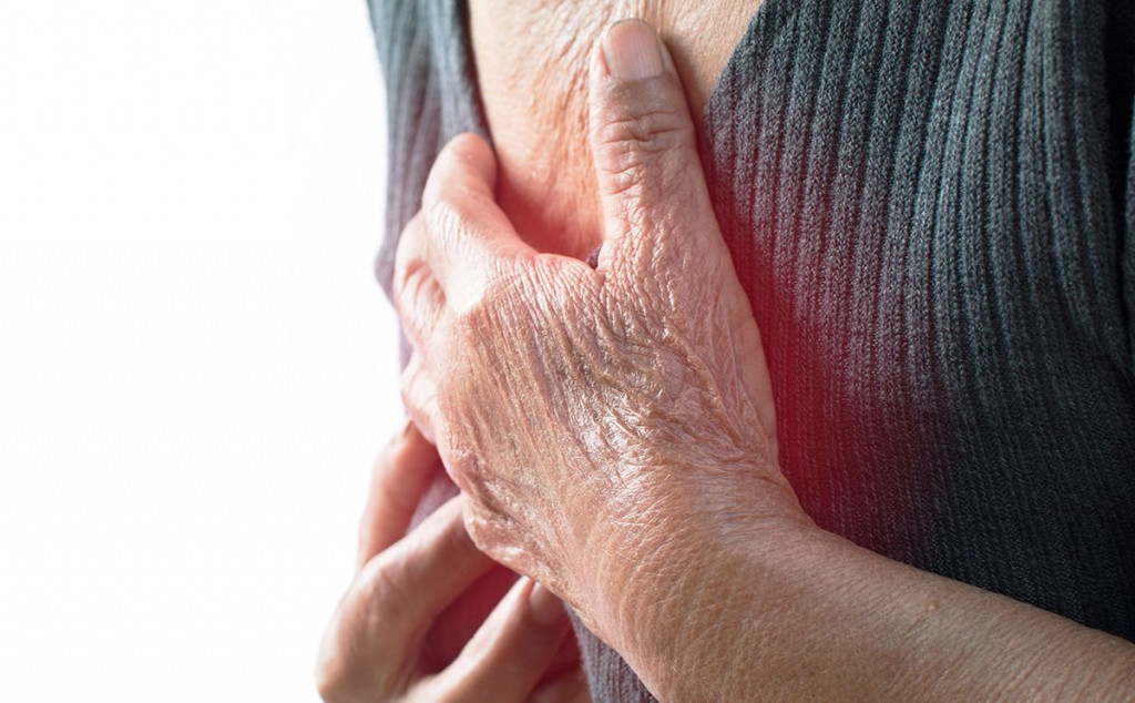 Srčani udar infarkt