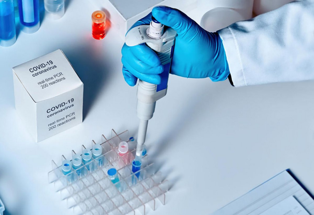 Testiranje covid 19