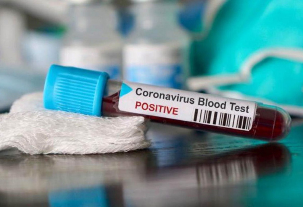 Koronavirus covid-19