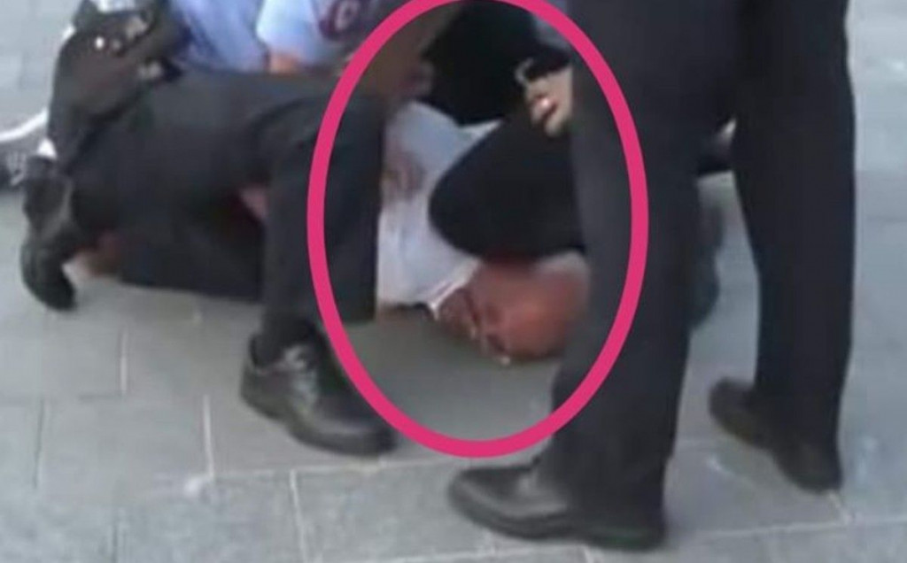 policija, policijska brutalnost