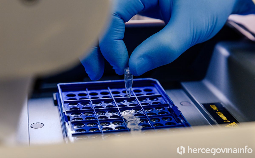 Koronavirus laboratorij