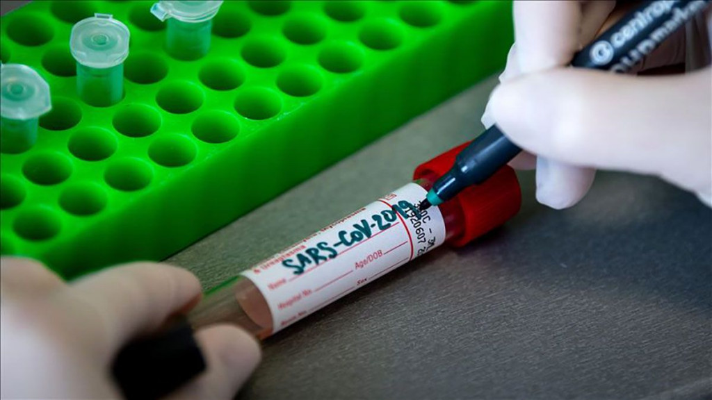 Covid 19 koronavirus