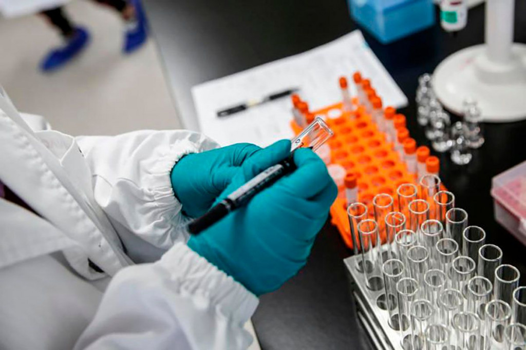 Covid 19 koronavirus test